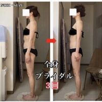 画像1395：ビフォーアフター