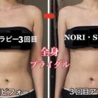 画像1424：ビフォーアフター