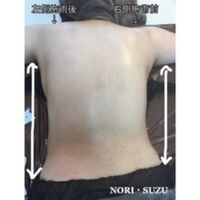 画像1426：ビフォーアフター