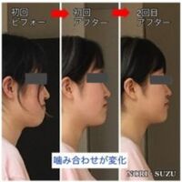 画像1432：ビフォーアフター