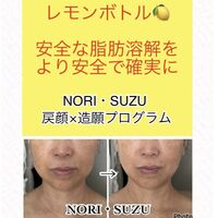 画像1811：ビフォーアフター