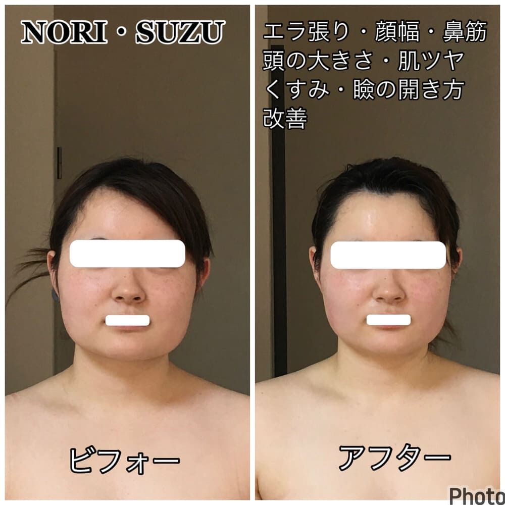 multi_image