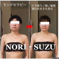 画像1827：ビフォーアフター