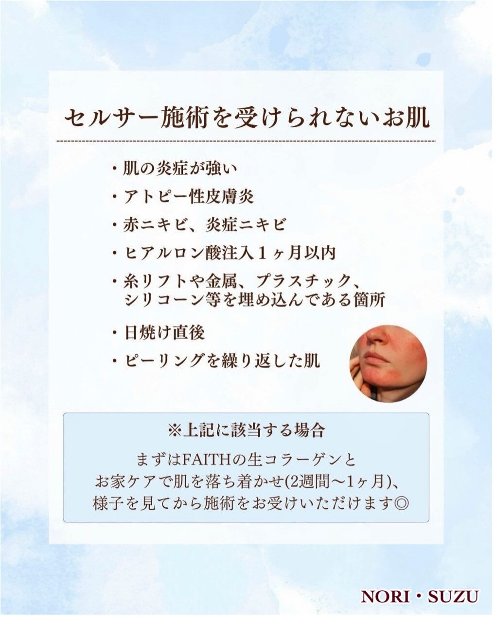 ＼本気で肌改善されたい方へ／